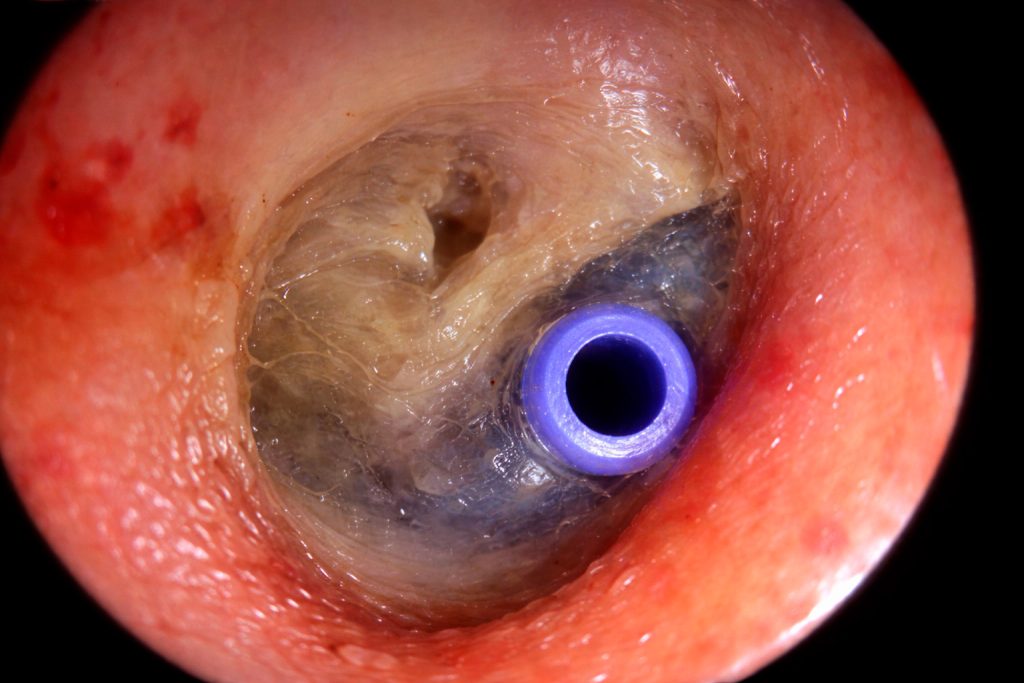 Tubo de ventilação